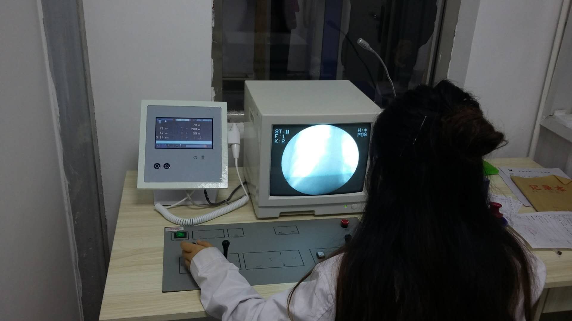 影像增强器