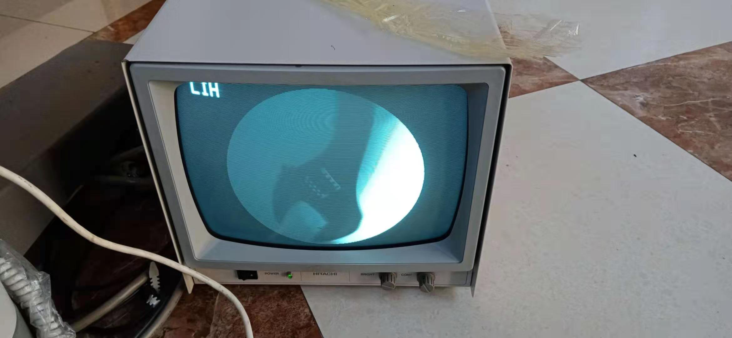 影像增强