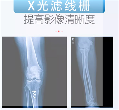 华鼎滤线栅 (5).jpg