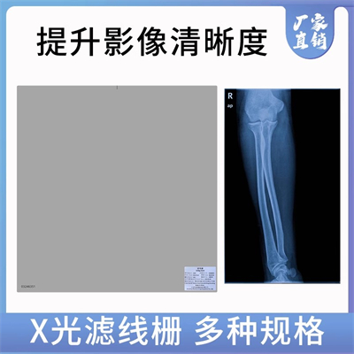 华鼎滤线栅 (18).jpg